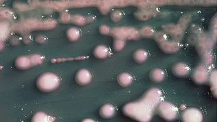 カルバペネム耐性腸内細菌（Carbapenem-resistant enterobacteriaceae、CRE）